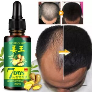 Germinal Oil Hair Growth Serum Anti Hair Loss Treatment